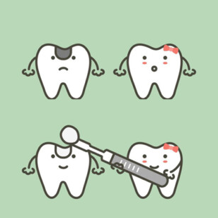 Dental Fillings
